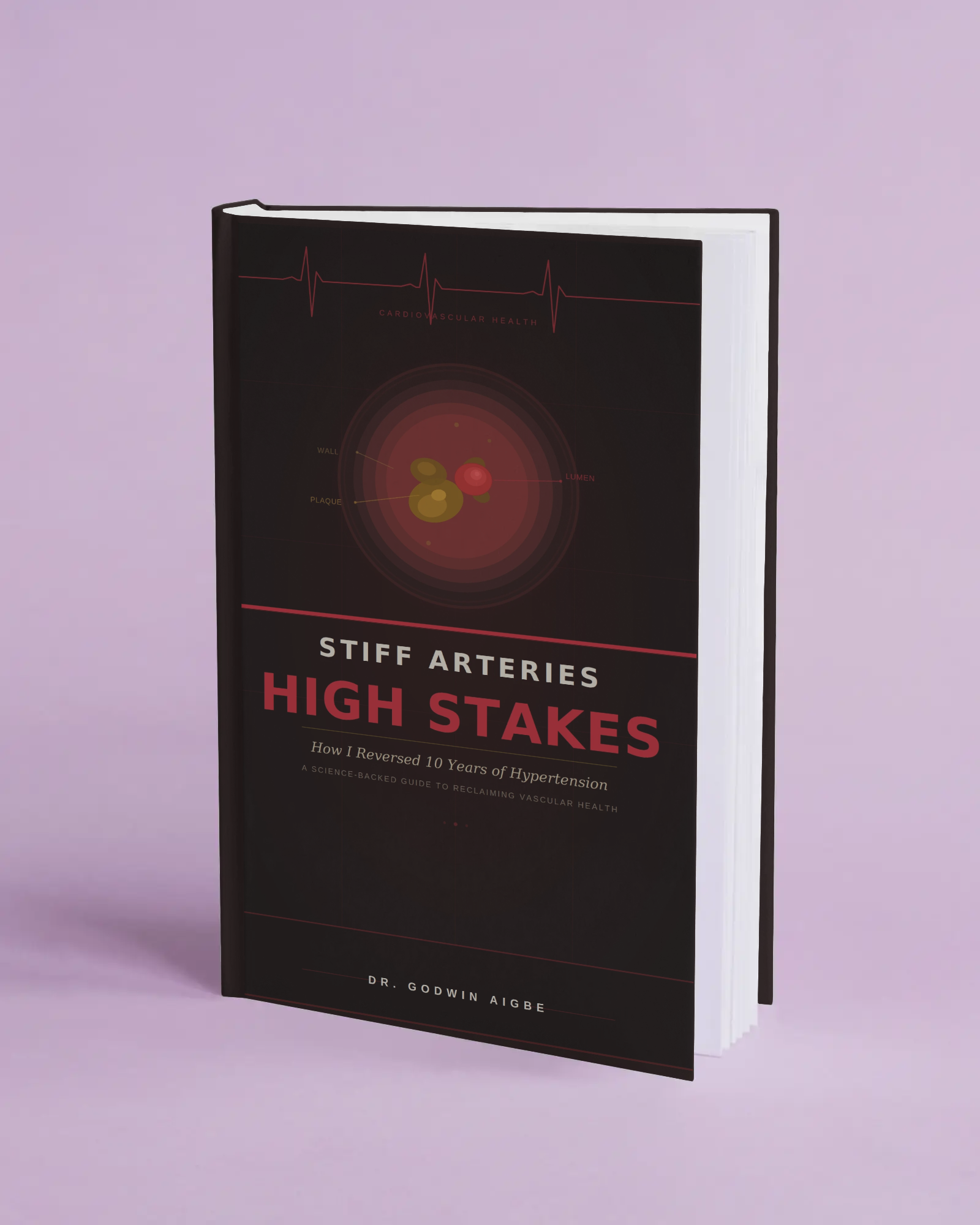 Front cover of Stiff Arteries, High Stakes by Dr Godwin Aigbe